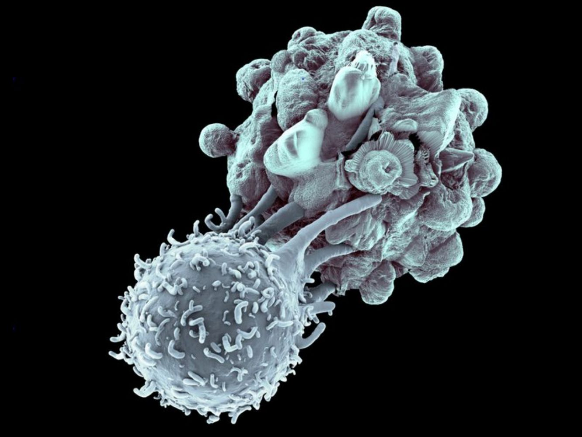 Т лимфоциты киллеры. Т лимфоциты под микроскопом. Клетки иммунной системы т-киллеры. Т- лимфоциты клетка. Цитотоксические т клетки