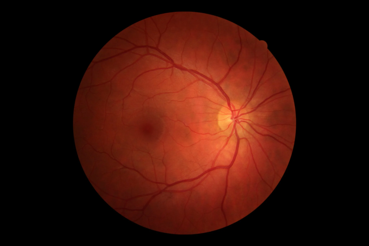 4 колбочки зрение. Дистрофия колбочек сетчатки. Рецепторы сумеречного зрения.
