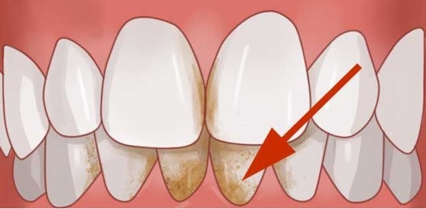 Нашла похожую картинку в интернете