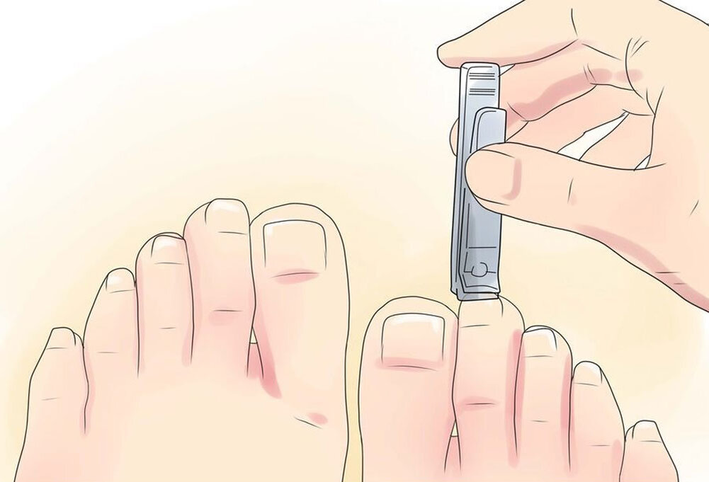 Как подстричь ногти по сунне