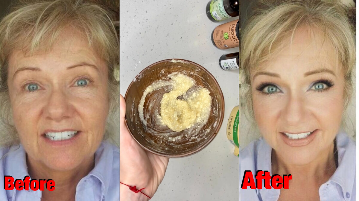 #маскаотморщин #морщины #омоложение #какубратьморщины #отбеливаниелица #каквыглядетьмоложе 