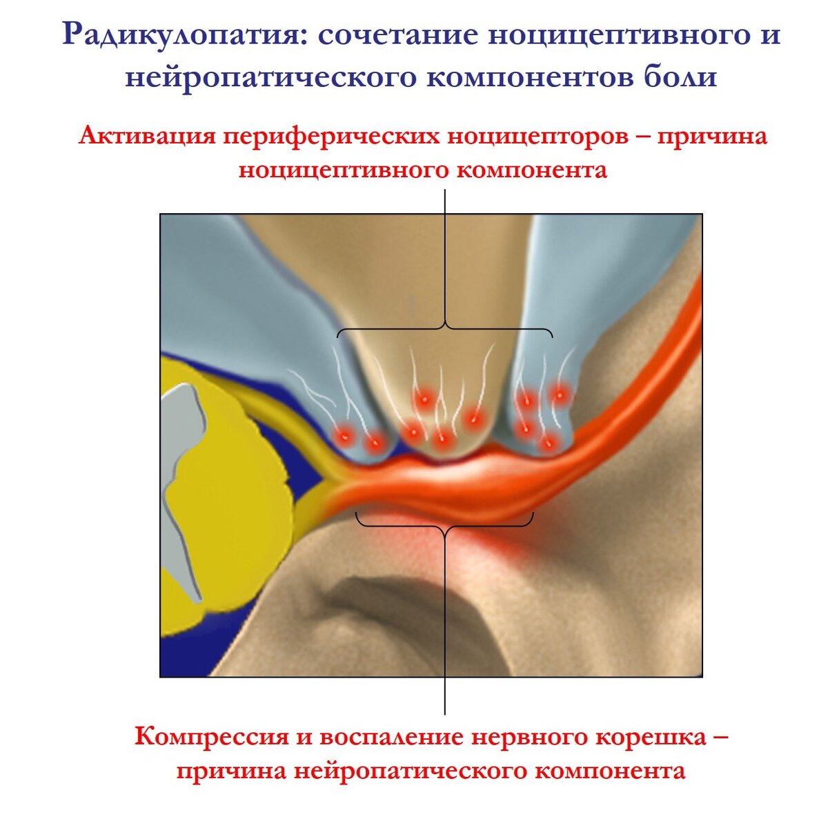-2-2