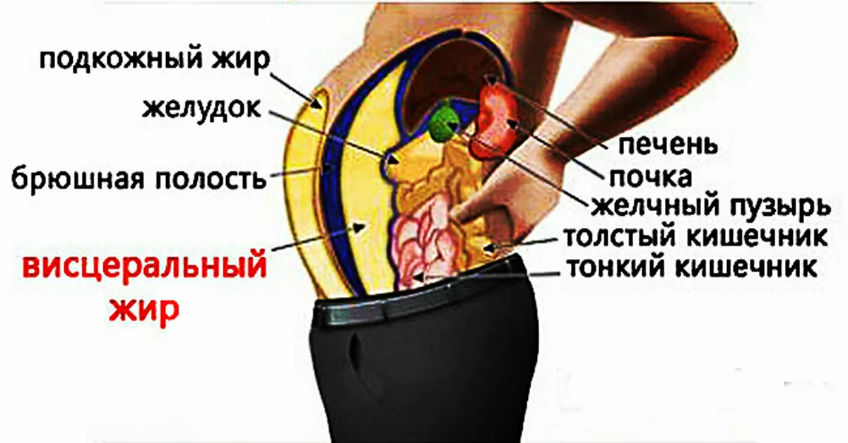 Висцеральный жир картинка