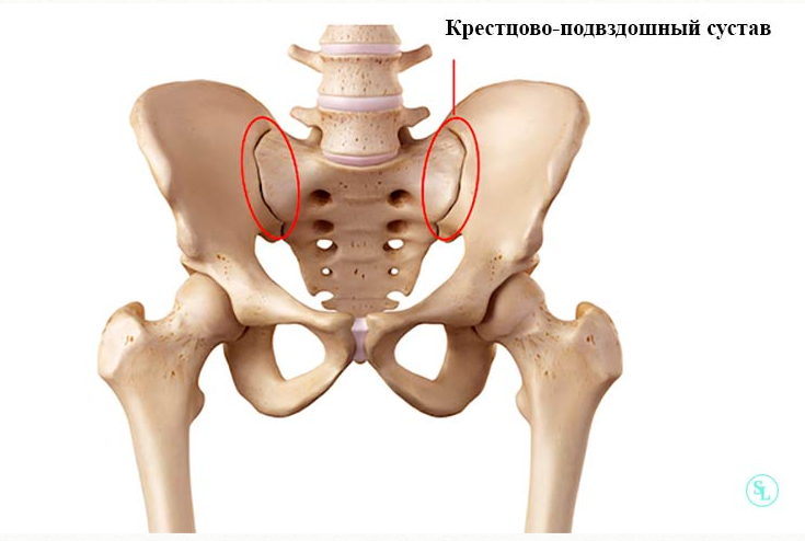 Сакроилеит: причины, симптомы, лечение
