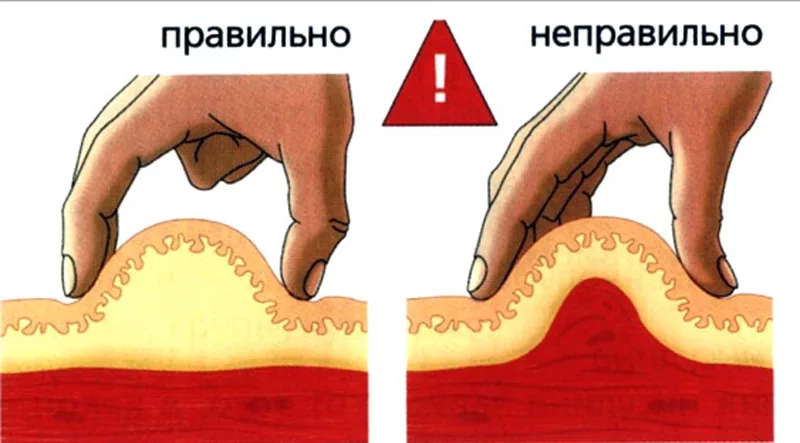 Куда колоть инсулин фото