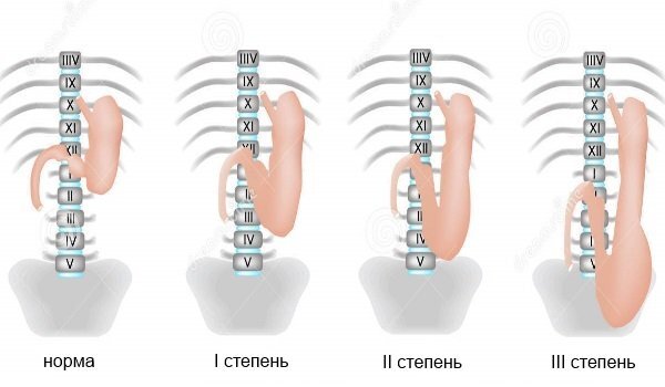 Боль в желудке - причины, лечение и диагностика