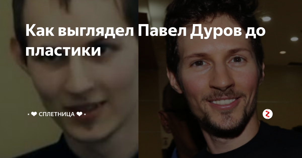 В чем секрет преображения Павла Дурова - отвечает пластический хирург Пятый кана