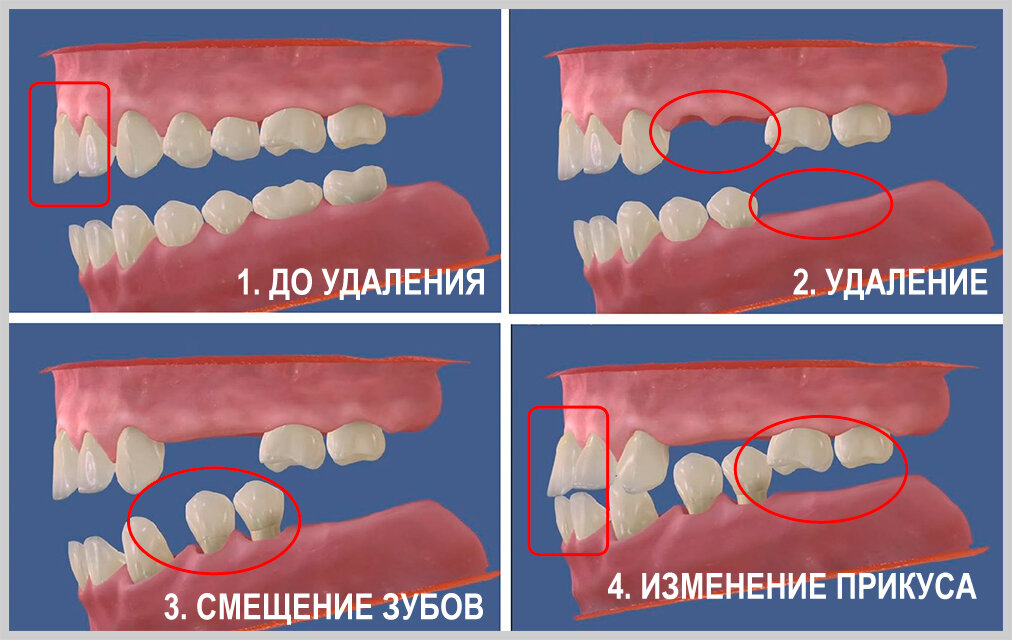 Фото с сайта sibdent.ru