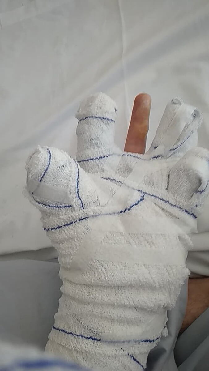 оптимальный вариант...