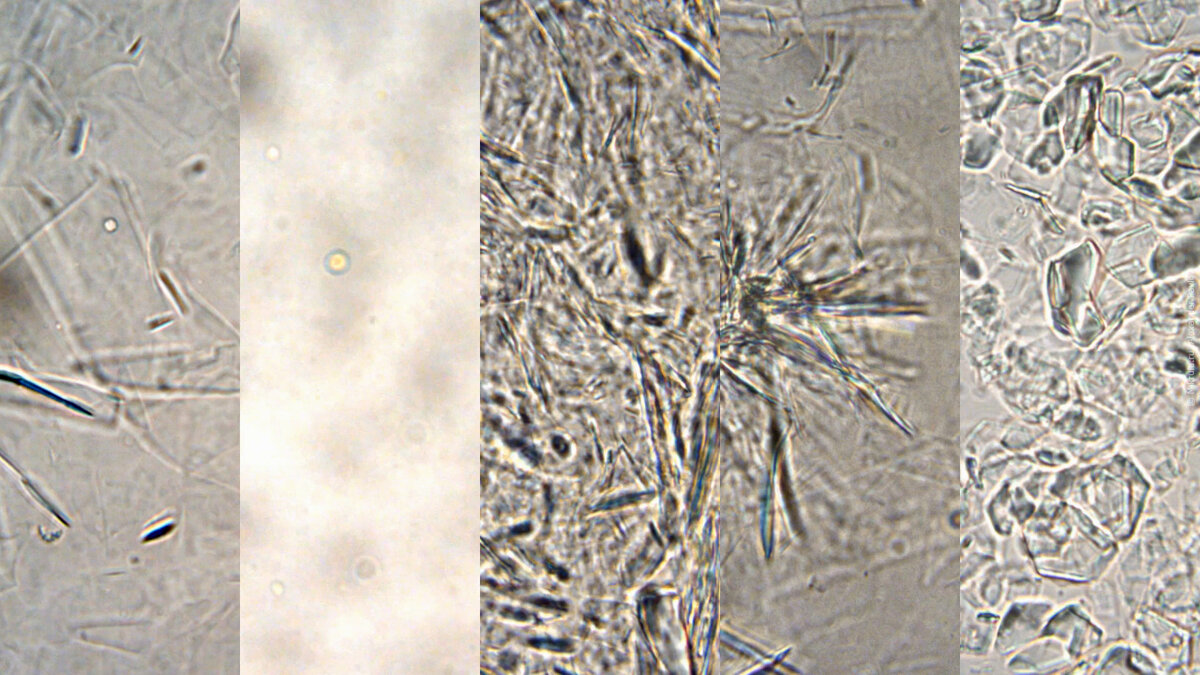 Мед под микроскопом картинки