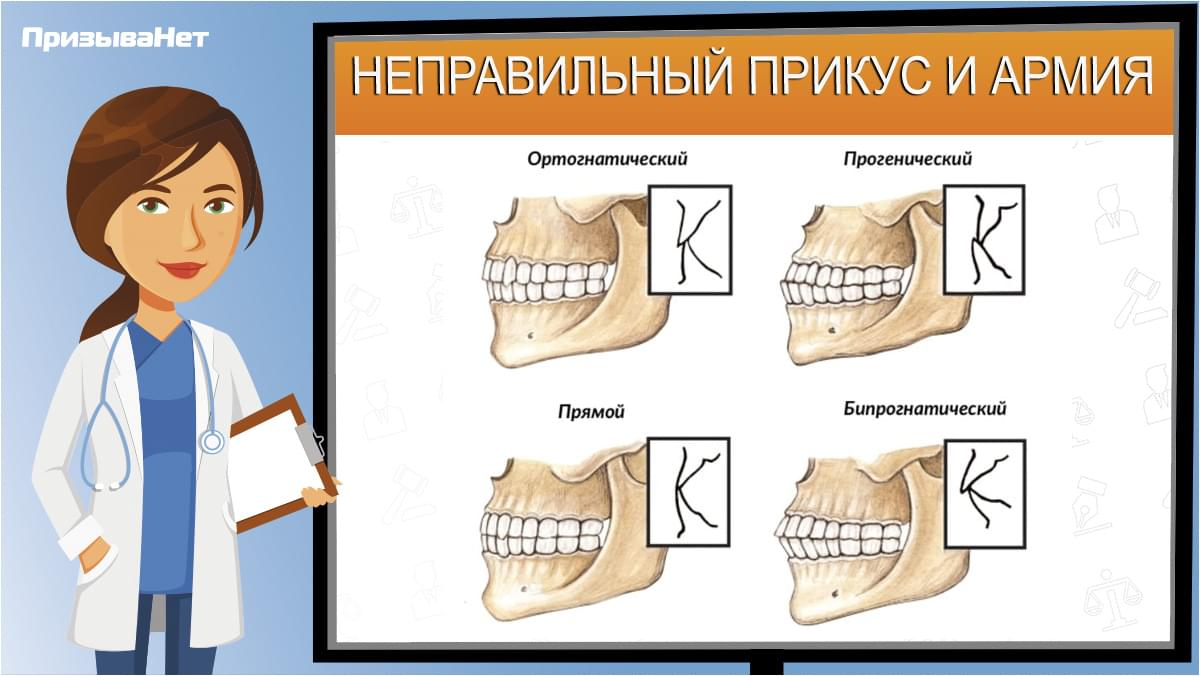 Виды неправильного прикуса. Источник: ПризываНет