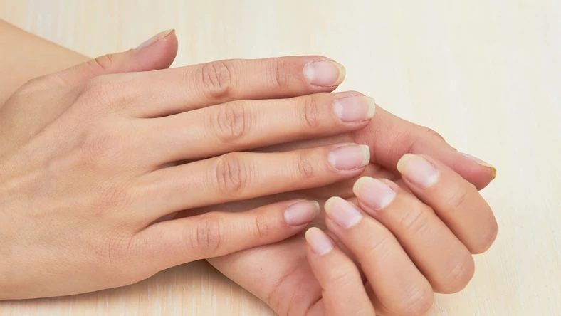 Сухость кожи