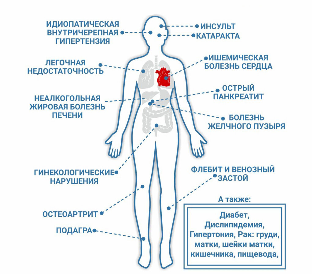 https://fc-ek.ru/info/articles/endokrinologiya/insulinorezistentnost/