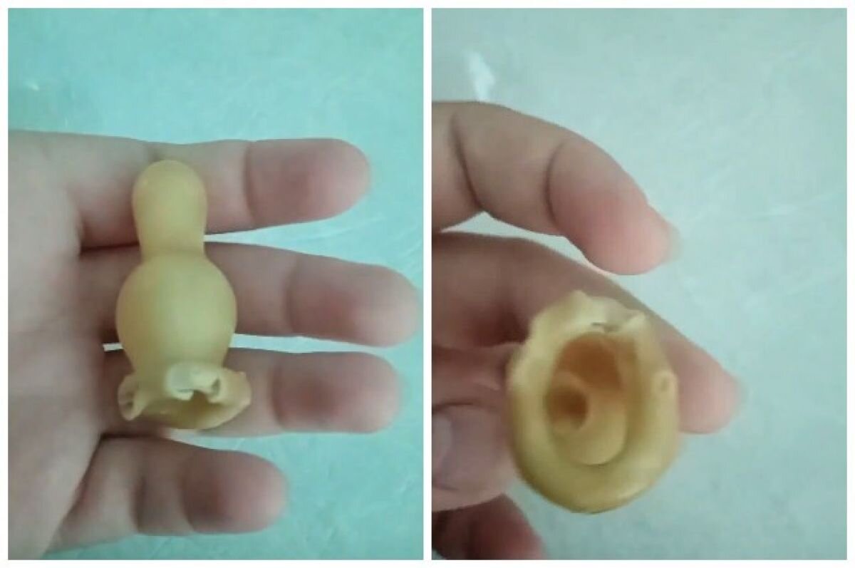    Жительница Искитима пожаловалась на дырявую соску в детской больнице