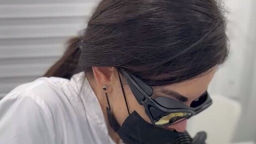 Sokolov Laser - Удаление тату | Шлифовка зашрамированной татуировки CO2 ...