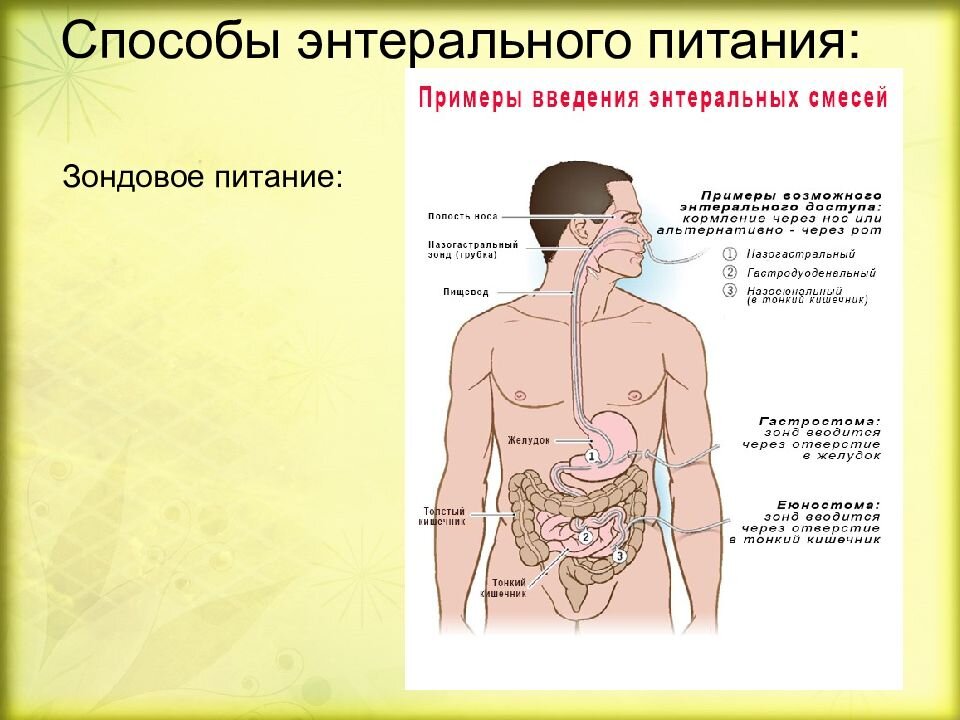 Зондовое питание какой стол