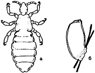 Головная вша рисунок