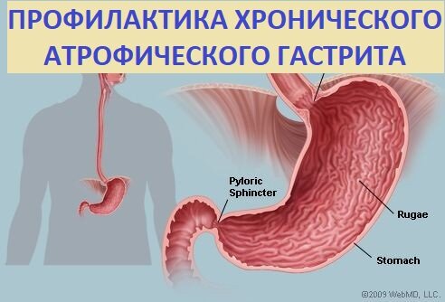 Основные причины возникновения