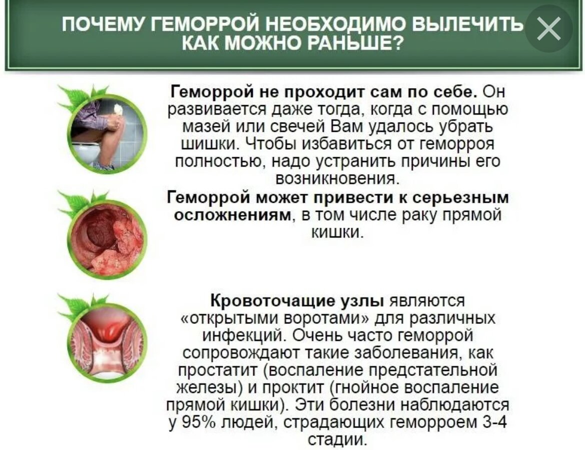 Воспаление наружного геморроя