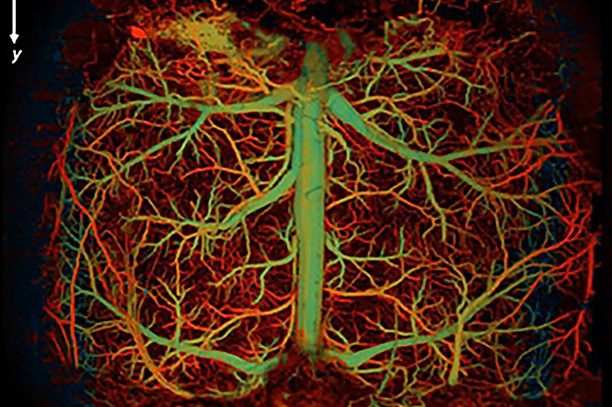     Создана сверхбыстрая система, визуализирующая процессы внутри мозга человека на молекулярном уровне