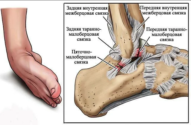 Связки голеностопного сустава фото анатомия