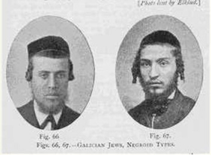 М. Фишберг «Евреи и окружающая среда»:: Галицкие евреи негроидного типа