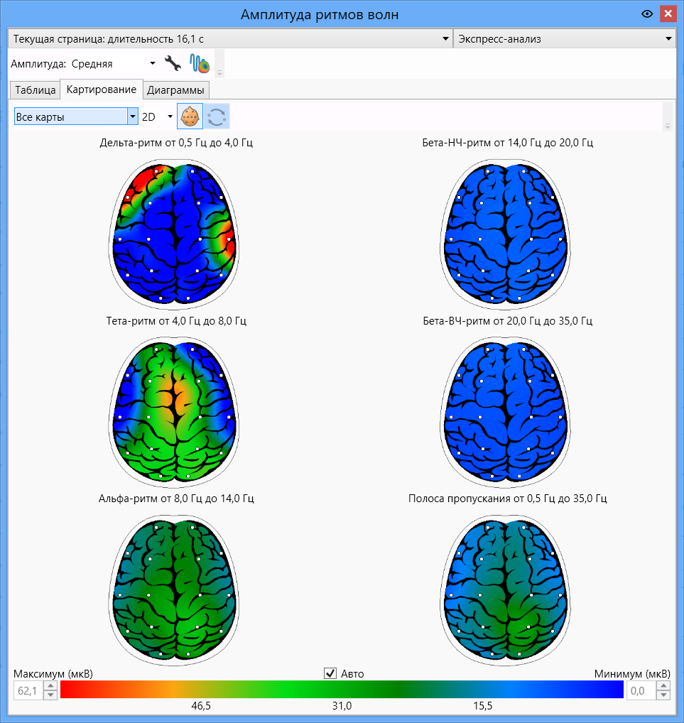 Пароксизмальная активность. Ээг картирование. Методы картирования мозга. Чертеж ээг компас. Программа для ээг на компьютере для ардуино.