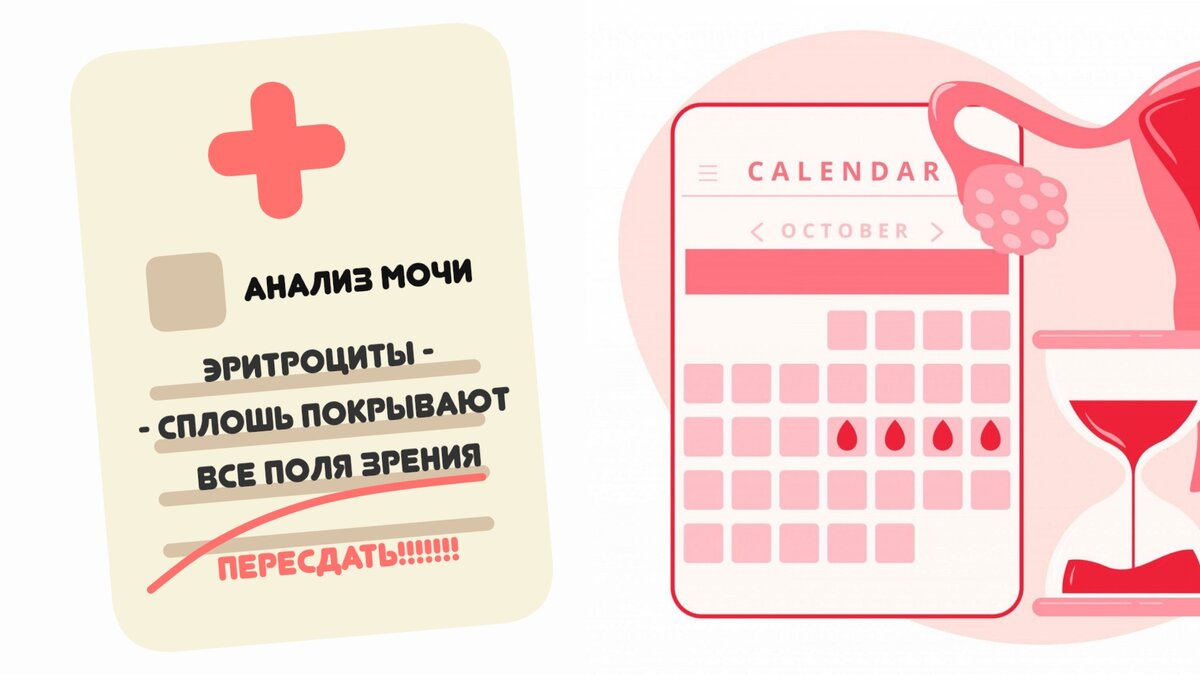 КАК ПРАВИЛЬНО СДАВАТЬ МОЧУ НА ОБЩИЙ АНАЛИЗ | MEDIKOFF | Дзен