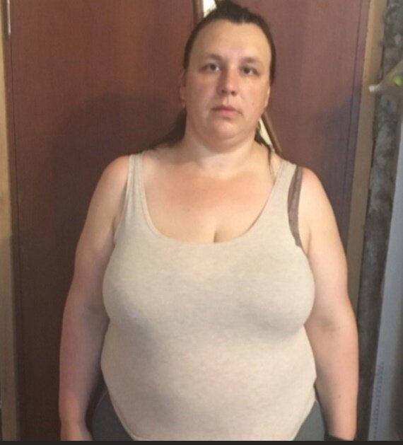 Лишний вес угнетал