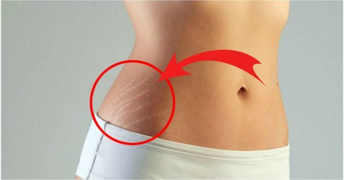 Уход за телом 