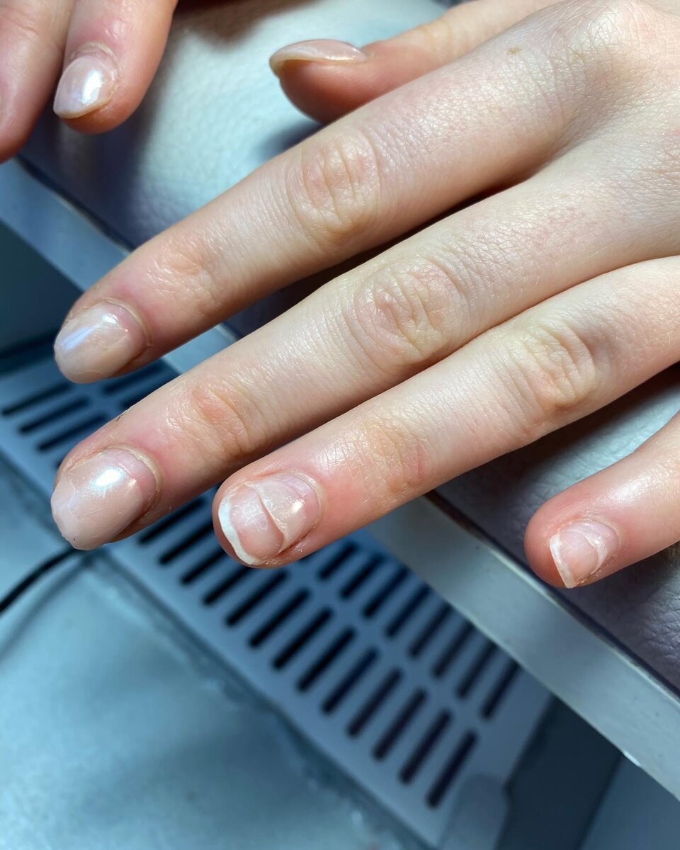 Оптимальный срок носки ногтей - 3-4 недели. Даже если ногти очень короткие, не стоит ждать пока они отрастут в два раза. На стрессовую зону идёт большая нагрузка при смещении апекса, начинают появляться сколы, трещины, отслойки. Ногти начинают истончаться, становиться ломкими и совсем теряют свой красивый, ухоженный вид.