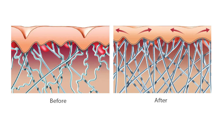 Коллаген в коже до и после нормализации рациона питания 