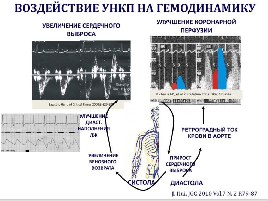 Воздействие УНКП на гемодинамику