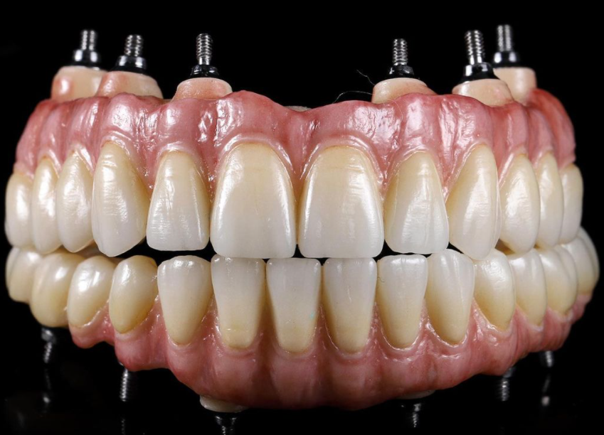 Источник наша зуботехническая лаборатория https://www.instagram.com/doctormartinlab/