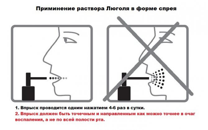 Фото с сайта https://vestesmile.ru/desny/r-lyugolya-s-glicerinom-instrukciya.html