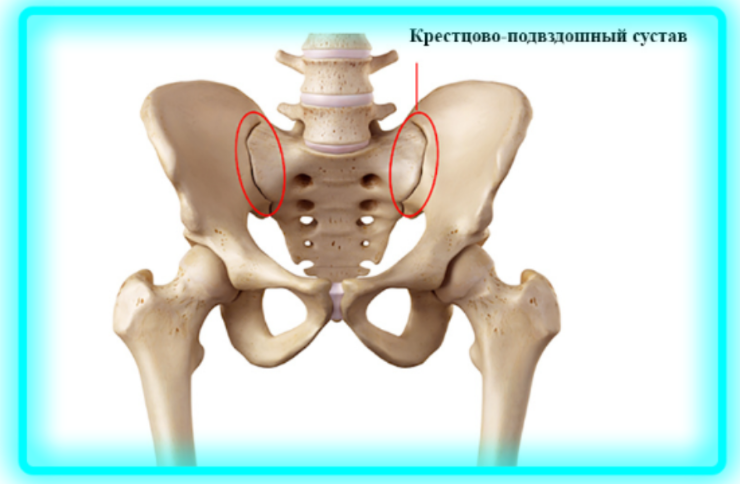 Крестцово подвздошный сустав фото
