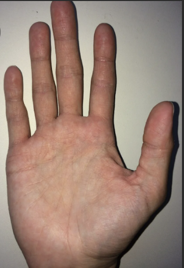 Развитый холм Нептуна