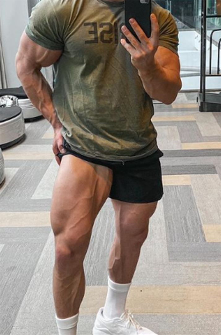 Большие ноги, фото взято из открытого источника(Яндекс Картинки)