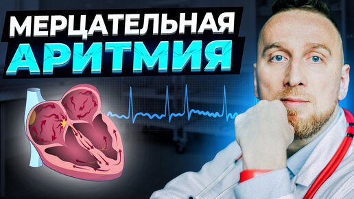 Download Video: Мерцательная аритмия. Фибрилляция предсердий с @Доктор Утин