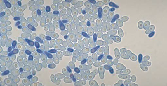 Малассезия под микроскопом