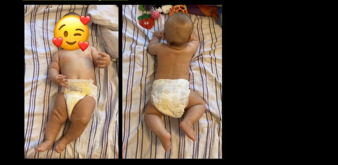 фотосессия малыша с бананами. фотосессия для грудничка с бананом. ребенок лежит бананом. поза банана у грудничка. поза банана у грудничка.