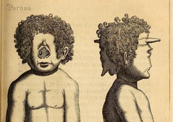 Рисунки в издании 1665 года книги Фортунио Лицети «Де Монстрис»