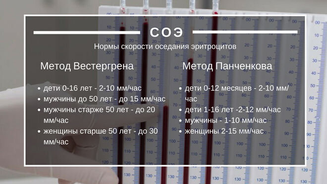 Норма соэ в крови таблица по возрасту