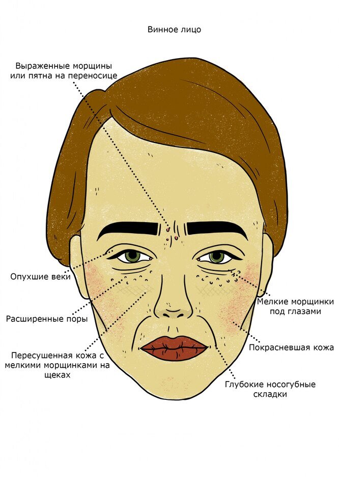 Прыщики на лице что означают. Сахарное лицо. Психосоматика прыщи на лице. Винное лицо.