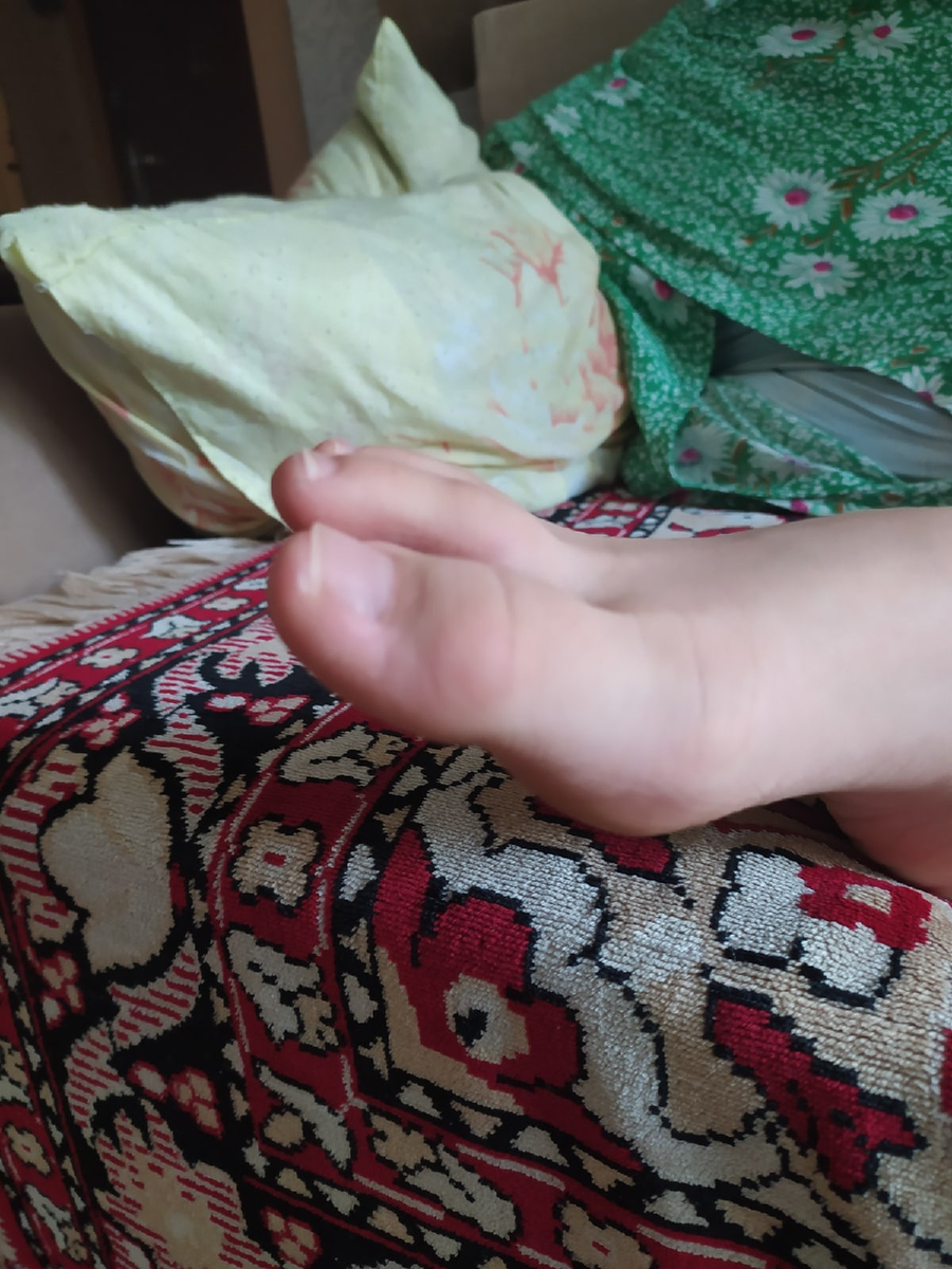 Так на фото не очень заметно, кажется что пальцы на одном уровне. Но по факту вот с такого ракурса мне на проблему и указали