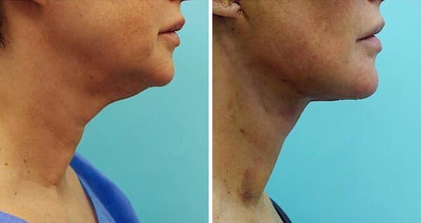 Фото из интернета