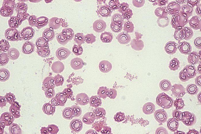 Бактерия Бруцелла, вызывающая бруцеллез