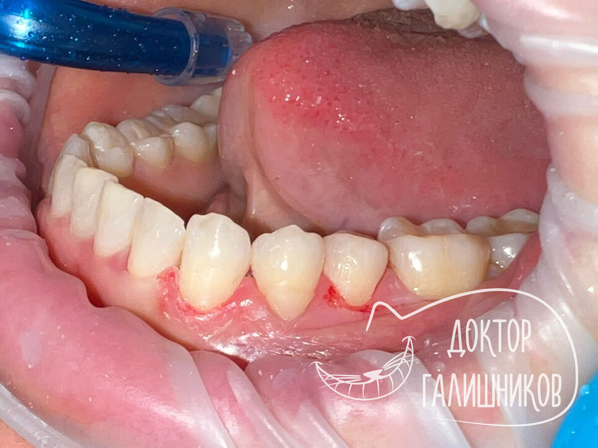 Если всё вовремя... | Галишников Олег | Дзен