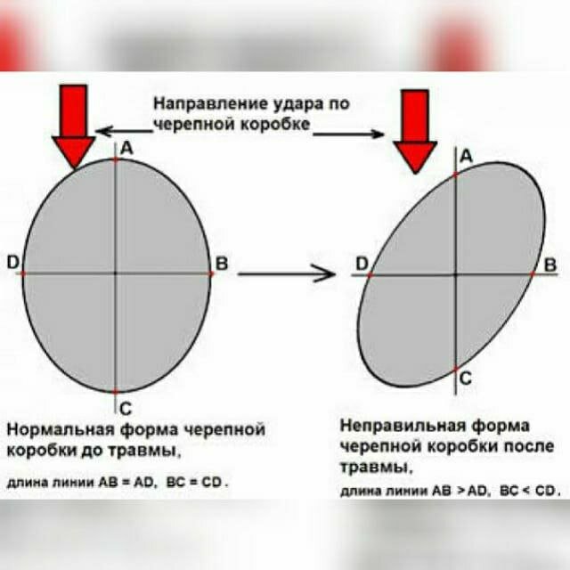 Изображение взято из открытых источников в интернете для иллюстрации
