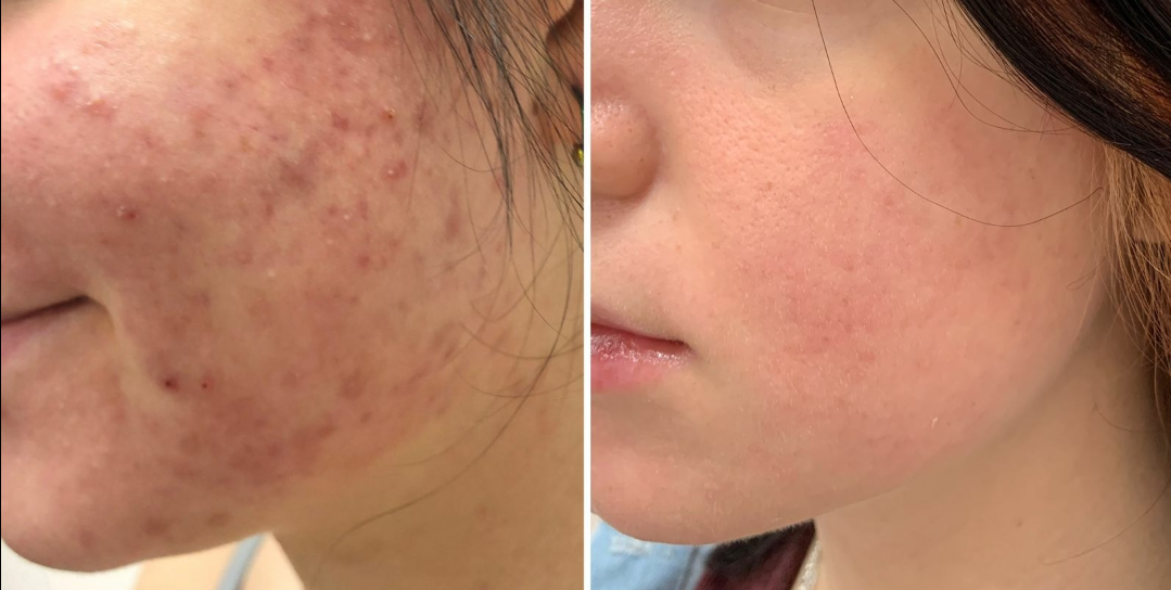 Работа врача-косметолога, дерматовенеролога GEN87 Лилии Федоровны Жажоян 